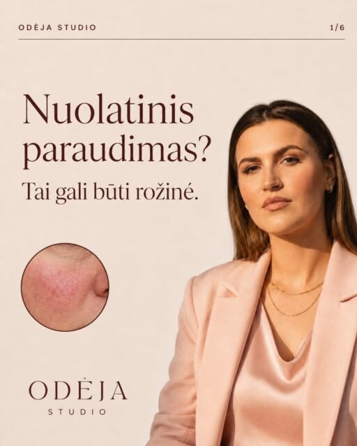 Ir vėl išraudo skruostai, veidas kaista bei persti, o jūs nežinote, ką daryti? Nors rožinės pažeistai odai reikia ypatingo atsargumo, tinkamai parinkta priežiūra gali efektyviai numalšinti uždegimą ir paraudimą. Perbraukite karuselę į šoną ir jei atpažystate save, parašykite man. Padėsiu 🤎
#veidorozine #sveikaoda #groziopatarimai #odosprieziura #kosmetologe