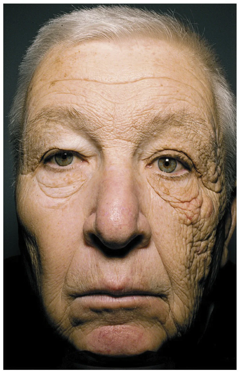 spf apsauga nuo saulės veidui